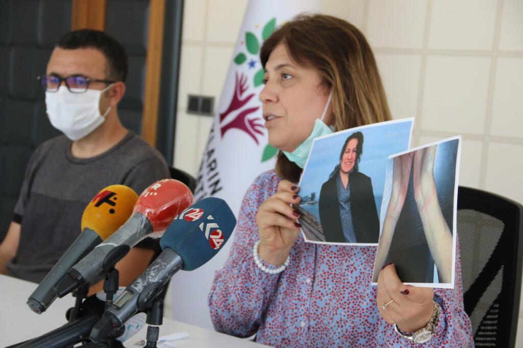 HDP, Diyarbakır’daki işkencenin belgelerini paylaştı