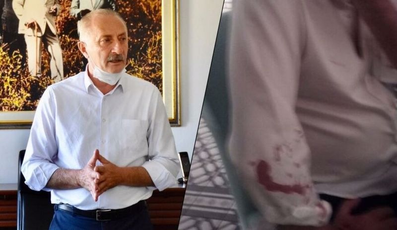 CHP’li belediye başkanına saldırıda 7 gözaltı