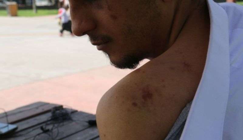 Taksim’de polis şiddetine uğrayan Kürt genç: ‘Şikayet etme sicilin bozulur’ dediler