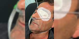 AKP ve Hüda-Parlılar saldırmıştı: Ahmet Akbulut gözünü kaybetti