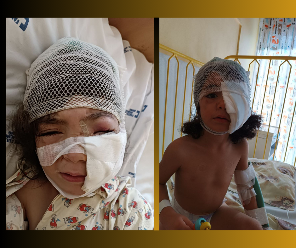 Çekya’da Kürt mülteci aileye köpekli işkence: Çocuğun yüzü parçalandı